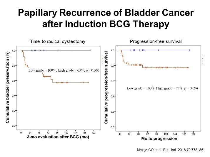 Papillary Recurrence Of Bladder Cancer After Induction Bcg Therapy 1066